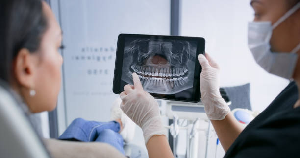 Licensed Dental Implants service in Laurel, MD - Smile Center Dentistry