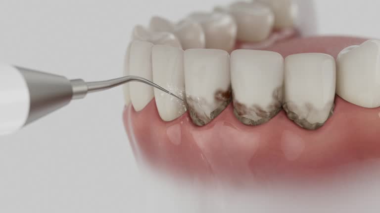 Reliable Dental Implants contractor in Laurel, MD by Smile Center Dentistry